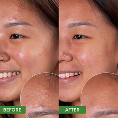 Sand & Sky Oil Control Clearing Cleanser 120ml