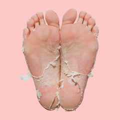 Skin Republic Pedi Peel Max Foot Mask 40ml Pack of 10