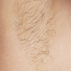 Apilus XCell Pur