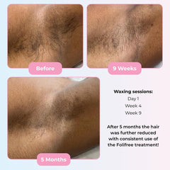 Depileve Foliprime Follicle Activator N.1 200ml