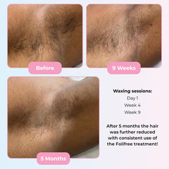 Depileve Foliprime Follicle Activator N.1 50ml